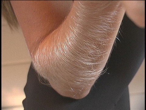 Hairy Arms Lori Anderson | Фото 19