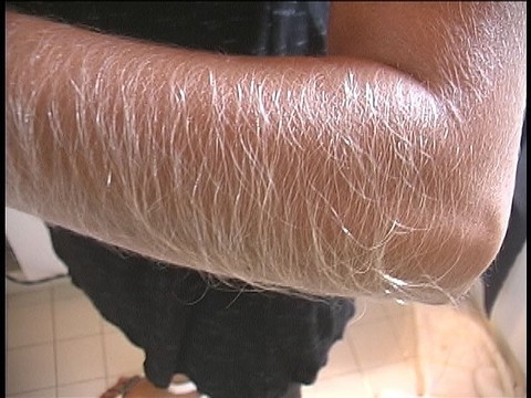 Hairy Arms Lori Anderson | Фото 3