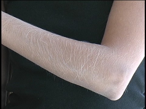 Hairy Arms Lori Anderson | Фото 3